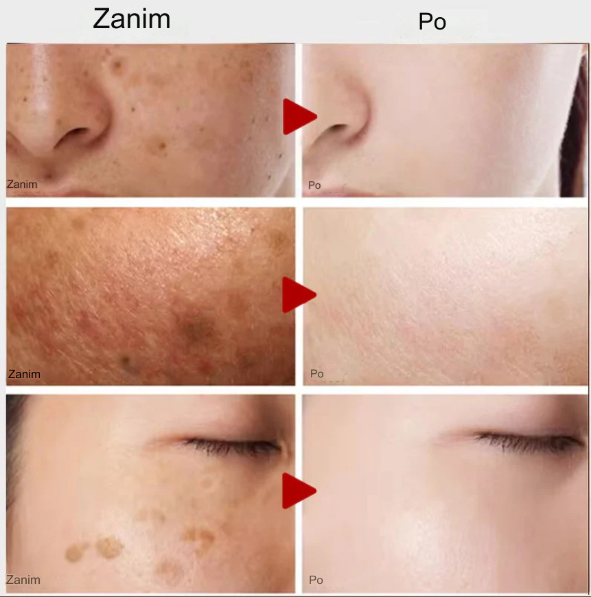 Bonatura+™️ Serum do twarzy z kurkumą | Odśwież swoją skórę i pozbądź się ciemnych plam na stałe!