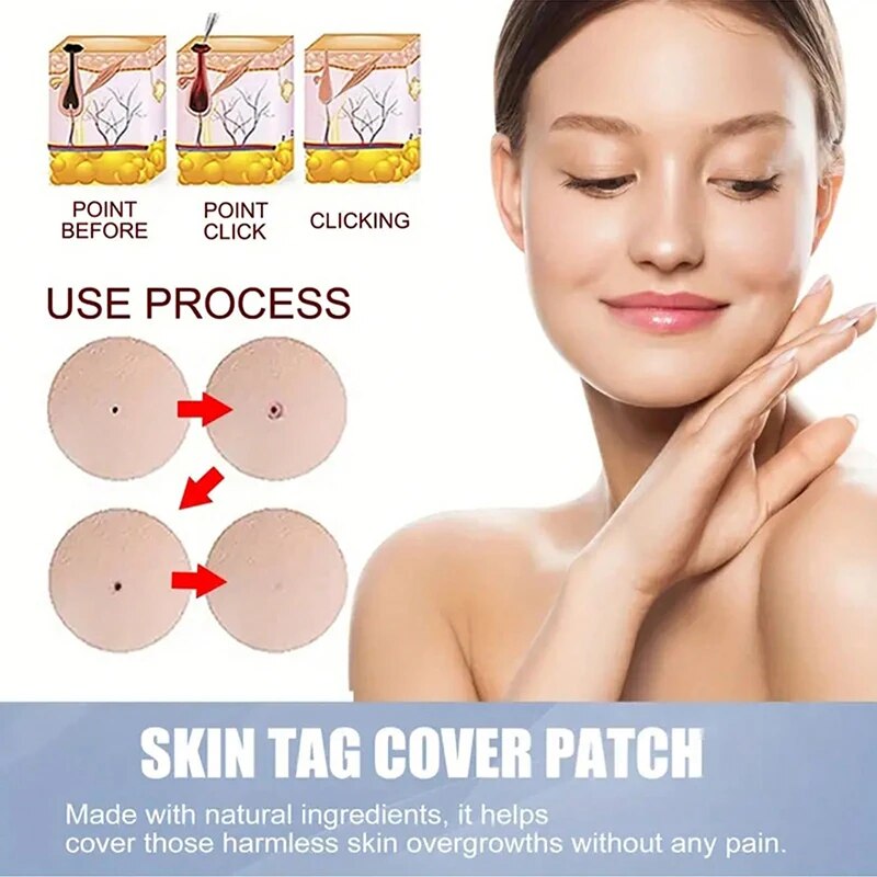 CoverLux™ Plastry do usuwania plam skórnych i pieprzyków