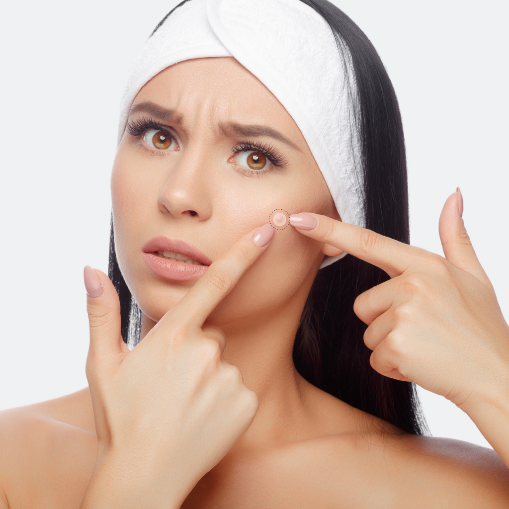 DermaReliv Pro+™️ Plastry usuwające plamy skórne