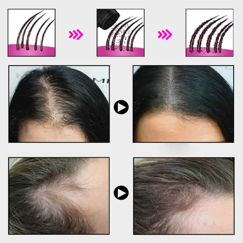 EELHOE HAIR™ Puder przeciw wypadaniu włosów i szybkie wypełnienie linii włosów