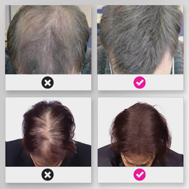 EELHOE HAIR™ Puder przeciw wypadaniu włosów i szybkie wypełnienie linii włosów