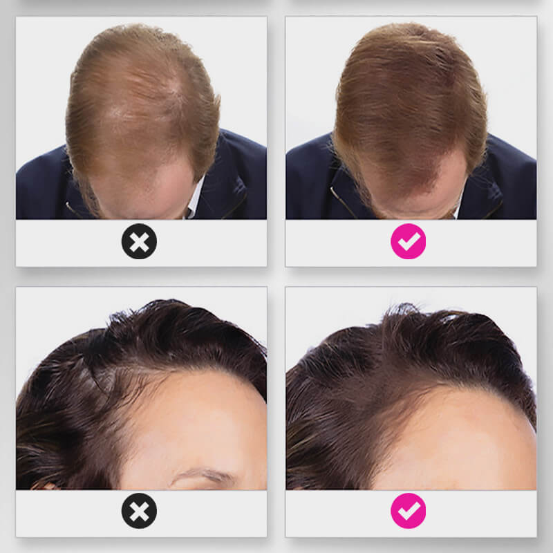 EELHOE HAIR™ Puder przeciw wypadaniu włosów i szybkie wypełnienie linii włosów