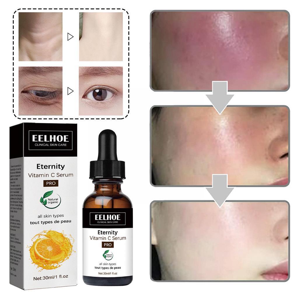 EELHOE Eternity™️ Serum korygujące ciemne plamy i przebarwienia
