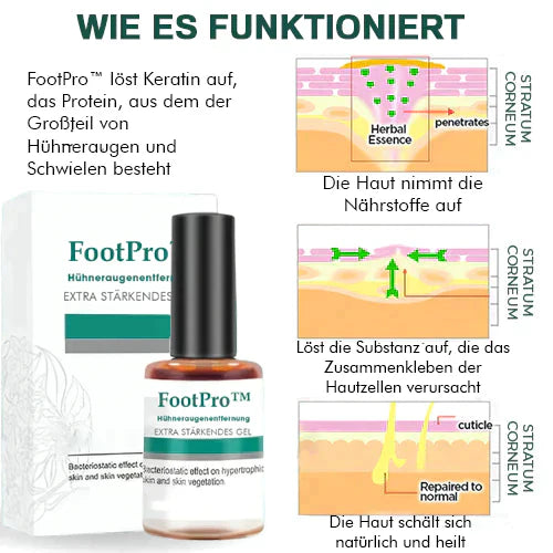 FootPro™️ Żel do usuwania kukurydzy