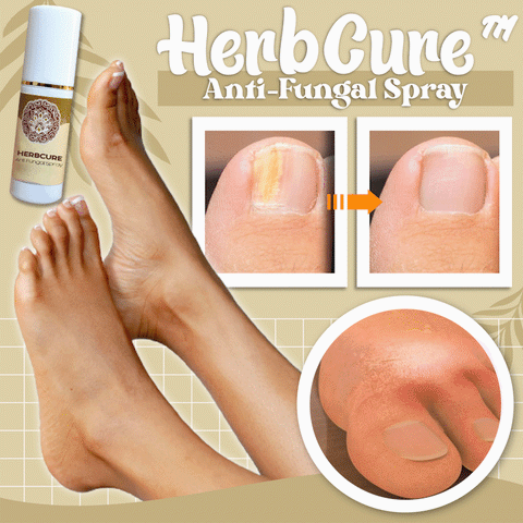 Herbcure™ Spray przeciwgrzybiczy