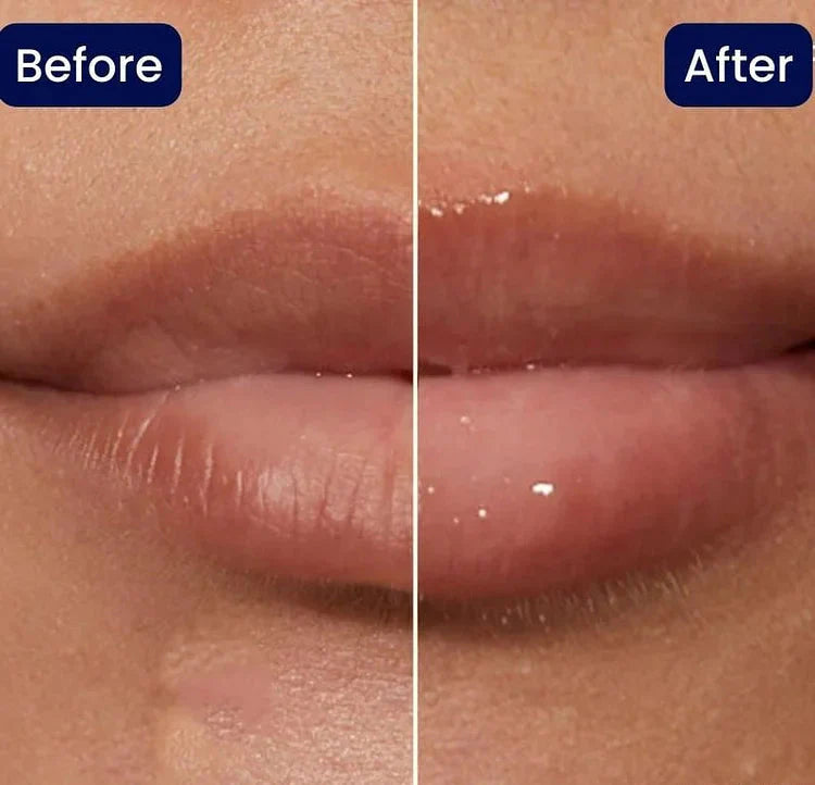 KissBeauty™ – serum powiększająco-wypełniające do ust w formie błyszczyka
