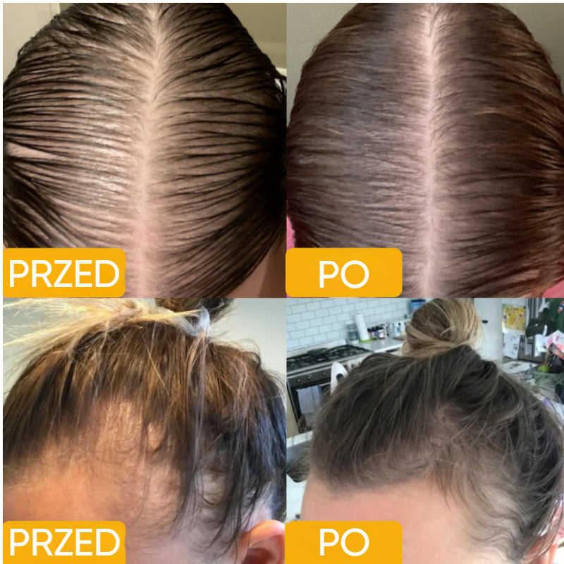 EELHOE Veghair+™ Wegański naturalny olejek na porost włosów | Gęste włosy są w zasięgu ręki!