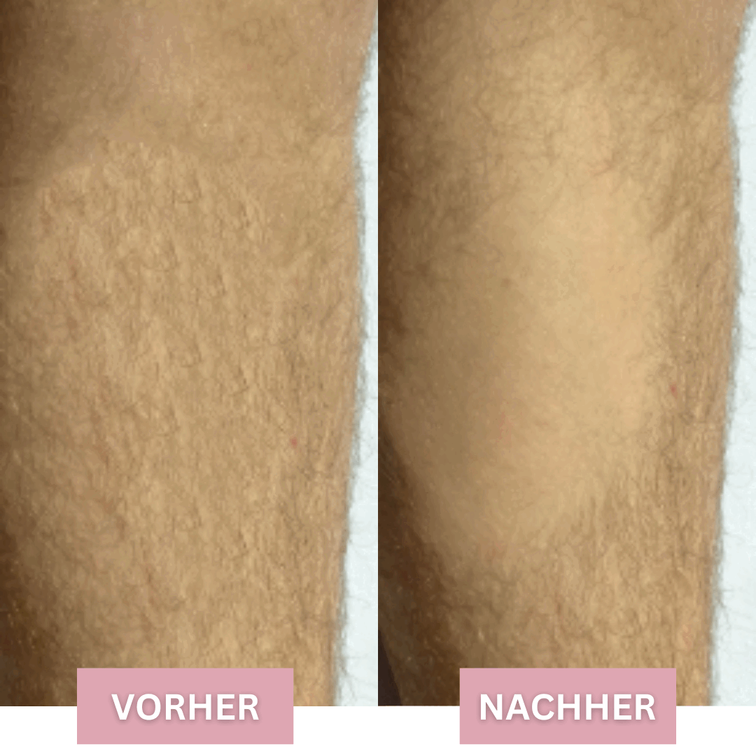 Silken Skin™ Urządzenie do usuwania włosów