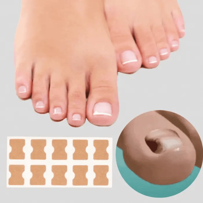 ToeFix+ Plastry na paznokcie | Skuteczna pomoc w walce z wrastającymi paznokciami!