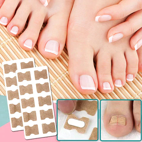 ToeFix+ Plastry na paznokcie | Skuteczna pomoc w walce z wrastającymi paznokciami!