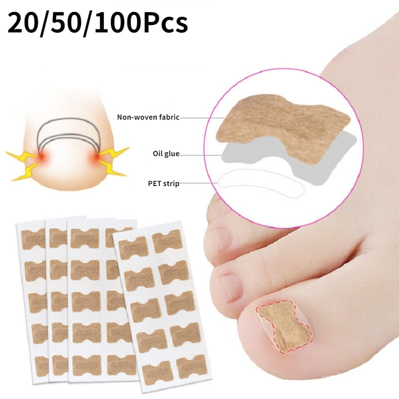 ToeFix+ Plastry na paznokcie | Skuteczna pomoc w walce z wrastającymi paznokciami!