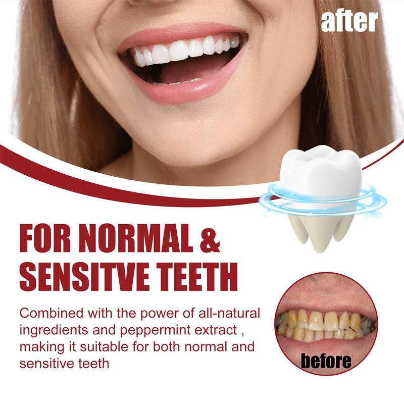 Vital Smile™ Pasta do zębów Super Probiotic-6 z 6 probiotykami