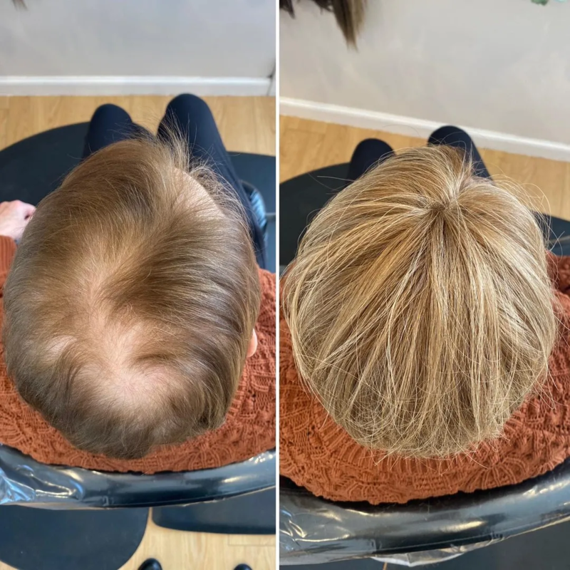 CrownLift™️ Miękka peruka zagęszczająca włosy