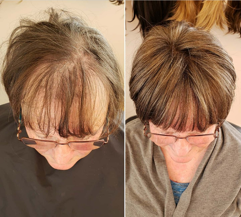 CrownLift™️ Miękka peruka zagęszczająca włosy