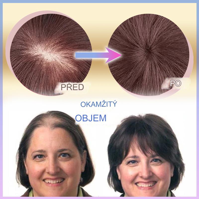 CrownLift™️ Miękka peruka zagęszczająca włosy