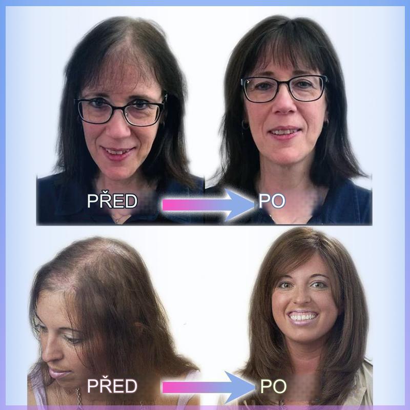 CrownLift™️ Miękka peruka zagęszczająca włosy