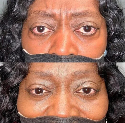 FrescaEye™ Krem pod oczy o natychmiastowym efekcie młodszego spojrzenia