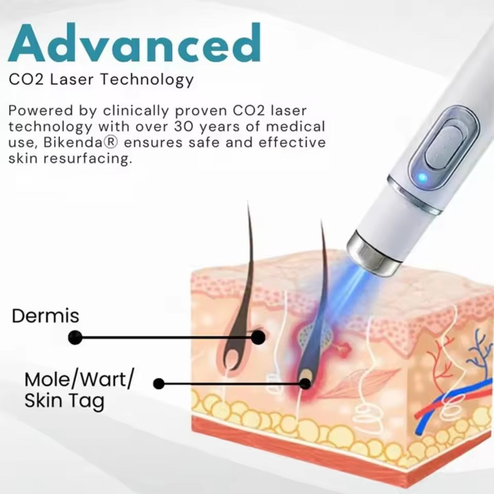 HOOMWELL™ – nieinwazyjny laser CO₂ do usuwania znamion, brodawek i plam skórnych