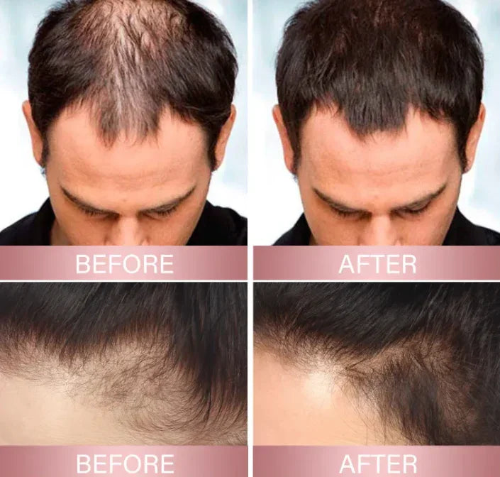 HairElixir™ Nawilżająca wcierka do skóry głowy przeciw wypadaniu włosów