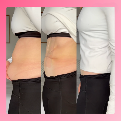 Invisilift™ Niewidoczne plastry ujędrniające skórę