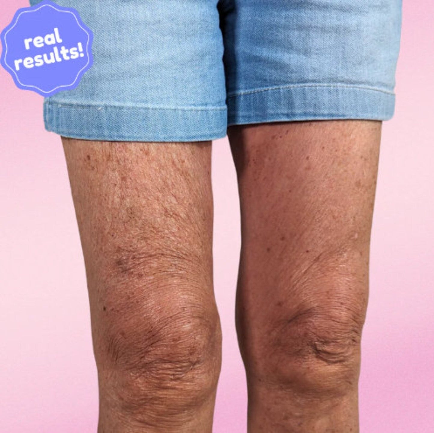 Invisilift™ Niewidoczne plastry ujędrniające skórę