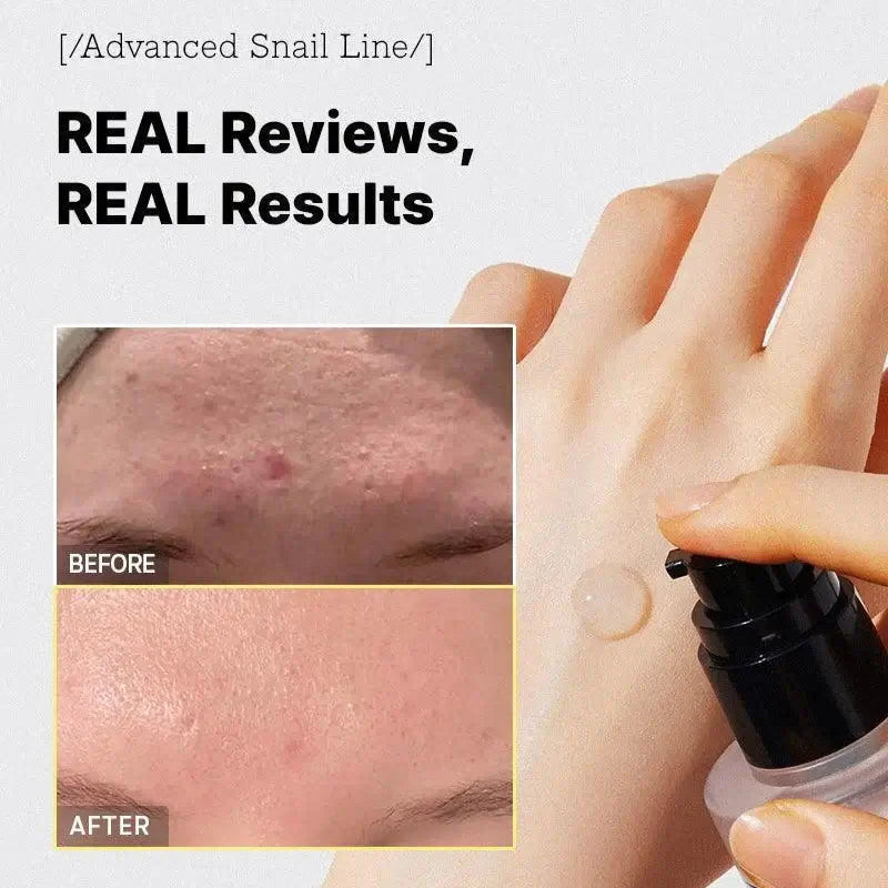 Mucisera™ Serum ze śluzem ślimaka