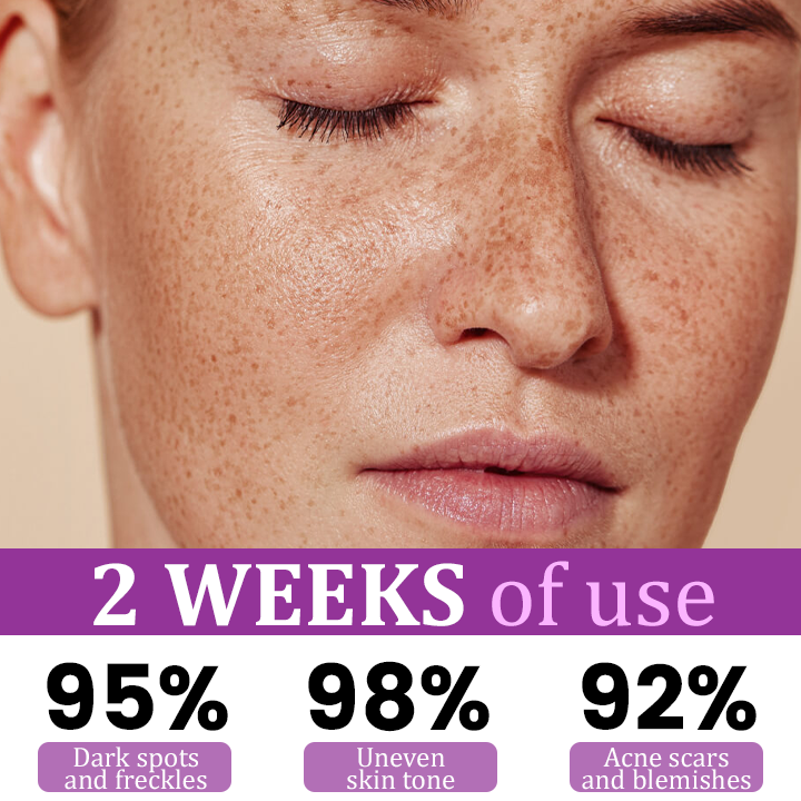 NicoGlow™ Rozjaśniające serum do skóry