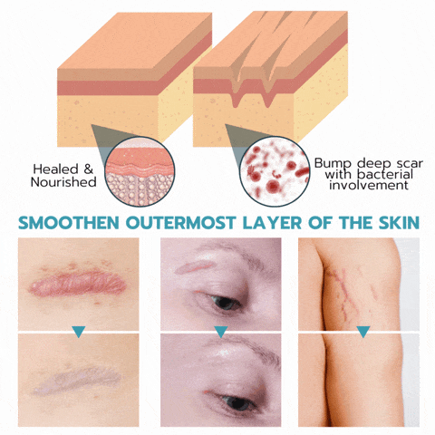 RejuvePatch™ Wielorazowe plastry na niedoskonałości twarzy