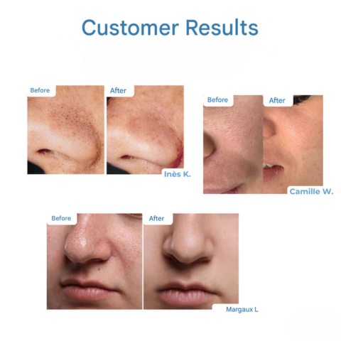 RevivaSkin™ Serum odmładzające skórę