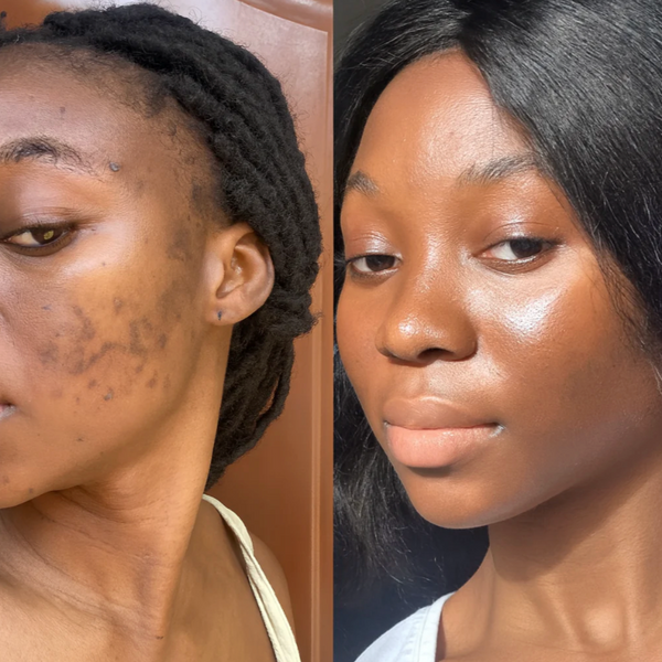 TallowCare™ Balsam do pielęgnacji skóry