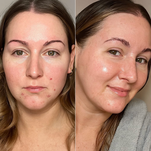 TallowCare™ Balsam do pielęgnacji skóry