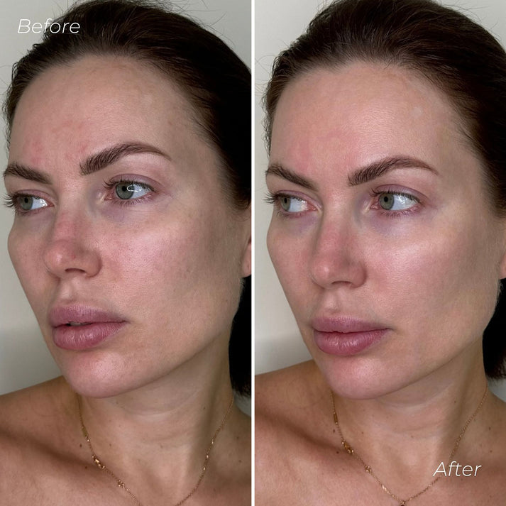 VegiHydra™ Ultra nawilżające serum roślinne