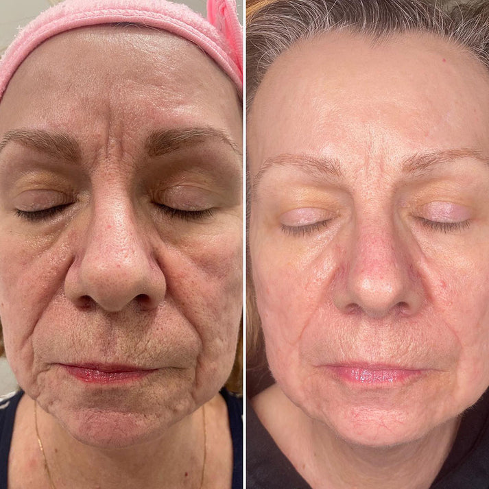VegiHydra™ Ultra nawilżające serum roślinne