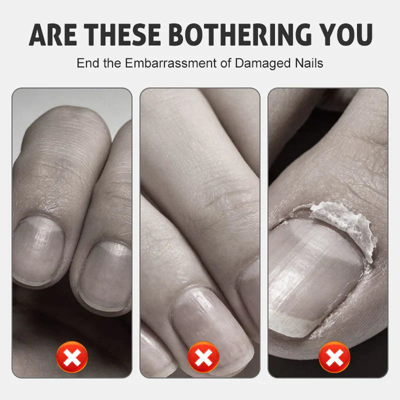 NourishNails™ Odżywcza regeneracja paznokci dla gładkich i zdrowych paznokci