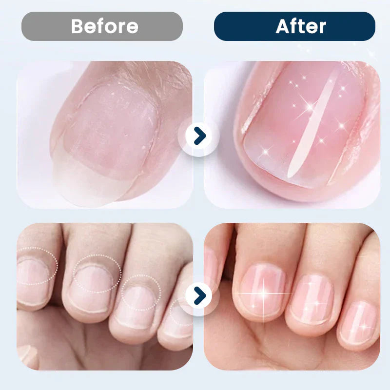 NourishNails™ Odżywcza regeneracja paznokci dla gładkich i zdrowych paznokci